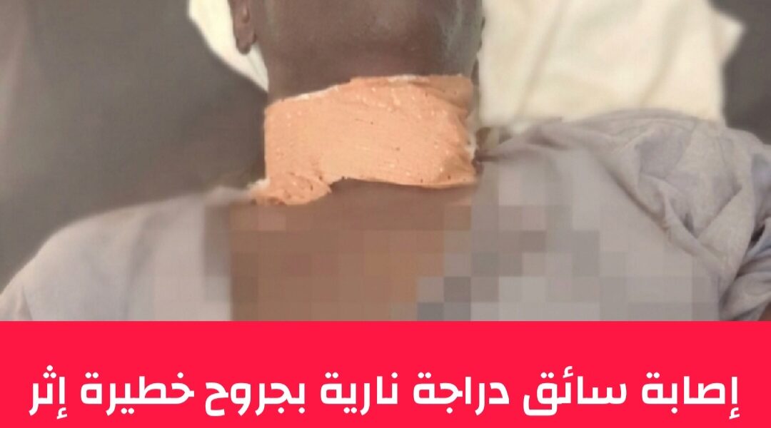 تشاد: إصابة سائق دراجة نارية في اعتداء بسلاح أبيض بالعاصمة أنجمينا