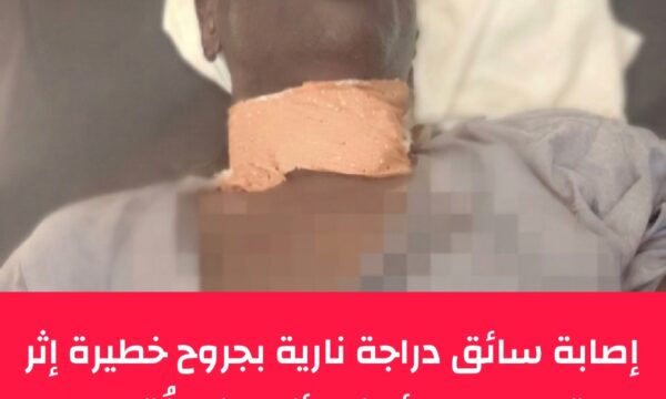 تشاد: إصابة سائق دراجة نارية في اعتداء بسلاح أبيض بالعاصمة أنجمينا